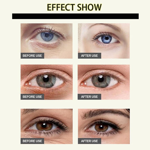 Anti-Wrinkle Essential Oil with VC & Lutein