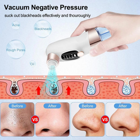 Blackhead Remover Pore Vacuum Cleaner Face Black Dot Pimple Acne