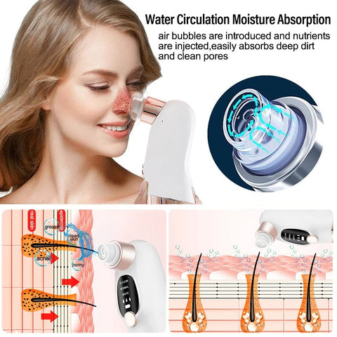 Blackhead Remover Pore Vacuum Cleaner Face Black Dot Pimple Acne